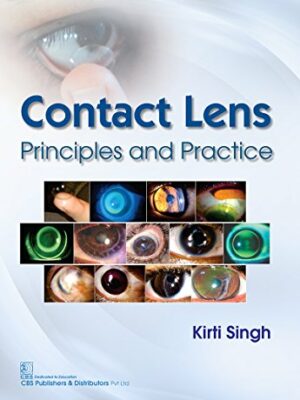 Contact Lens Printiples and Practice Modern System of Ophthalmology MSO