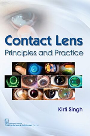 Contact Lens Printiples and Practice Modern System of Ophthalmology MSO