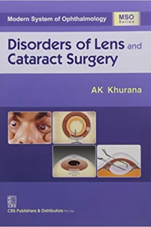 Disorders Of Lens An Cataract Surgery Modern System of Ophthalmology