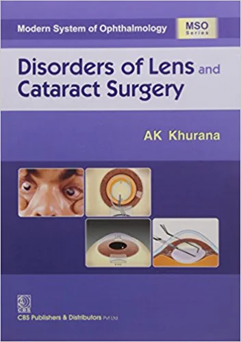 Disorders Of Lens An Cataract Surgery Modern System of Ophthalmology