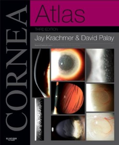 cornea atlas expert consult online and print 3rd 246x3001 1