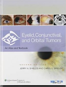 eyelid conjunctival and orbital tumors an atlas and text 228x3001 1