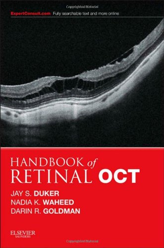 handbook of retinal oct optical coherence tomography 1e