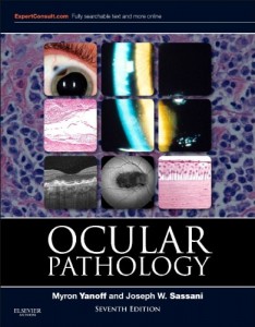 ocular pathology expert consult online and print 7e 234x3001 1