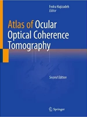 Atlas of Ocular Optical Coherence Tomography 2nd
