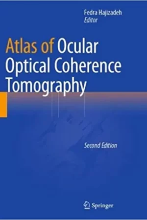 Download ophthalmology & optometry books PDF - Ophthalmology Library 27 Atlas of Ocular Optical Coherence Tomography 2nd