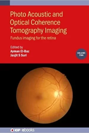Photo Acoustic and Optical Coherence Tomography Imaging Fundus Imaging for the Retina Volume 2 1