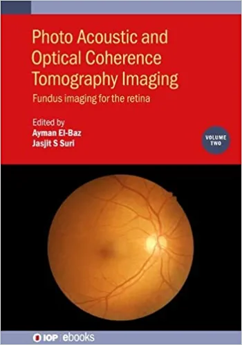 Photo Acoustic and Optical Coherence Tomography Imaging Fundus Imaging for the Retina Volume 2 1