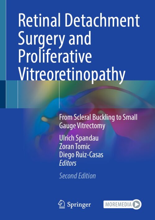 Retinal Detachment Surgery and Proliferative Vitreoretinopathy 2nd Edition
