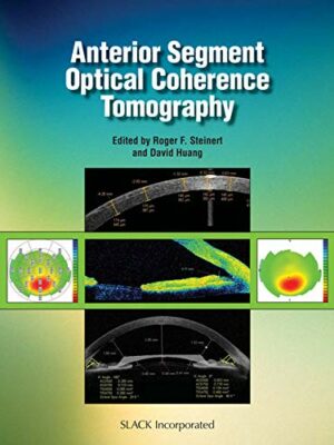 Anterior Segment Optical Coherence Tomography