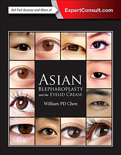 Asian Blepharoplasty and the Eyelid Crease 3rd Edition