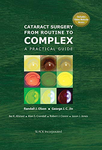 Cataract Surgery from Routine to Complex A Practical Guide