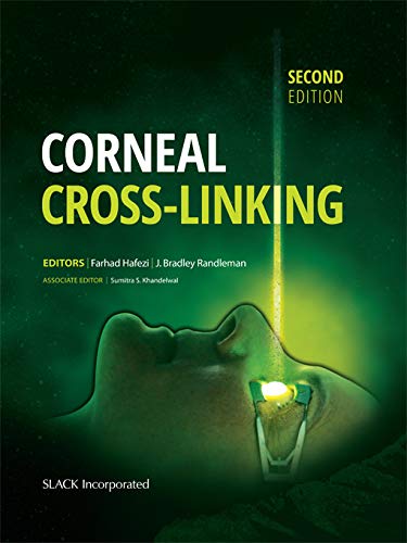 Corneal Cross Linking Second Edition
