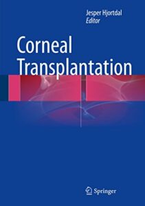 Corneal Transplantation