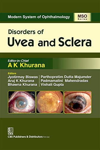 Disorders of Uvea and Sclera