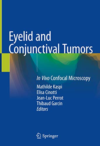 Eyelid and Conjunctival Tumors In Vivo Confocal Microscopy