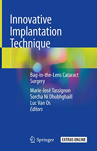 Innovative Implantation Technique Bag in the Lens Cataract Surgery
