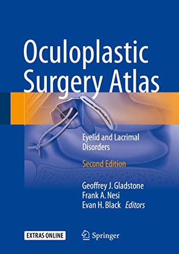 Oculoplastic Surgery Atlas Eyelid and Lacrimal Disorders 2nd Edition