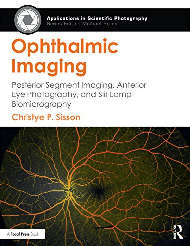 Ophthalmic Imaging Posterior Segment Imaging Anterior Eye Photography and Slit Lamp Biomicrography Applications in Scientific Photography