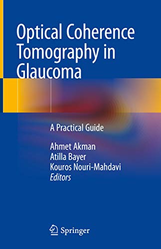 Optical Coherence Tomography in Glaucoma A Practical Guide