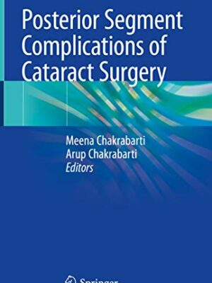 Posterior Segment Complications of Cataract Surgery
