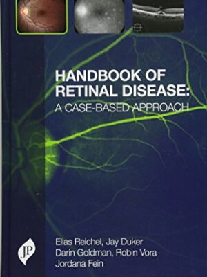handbook of retinal disease