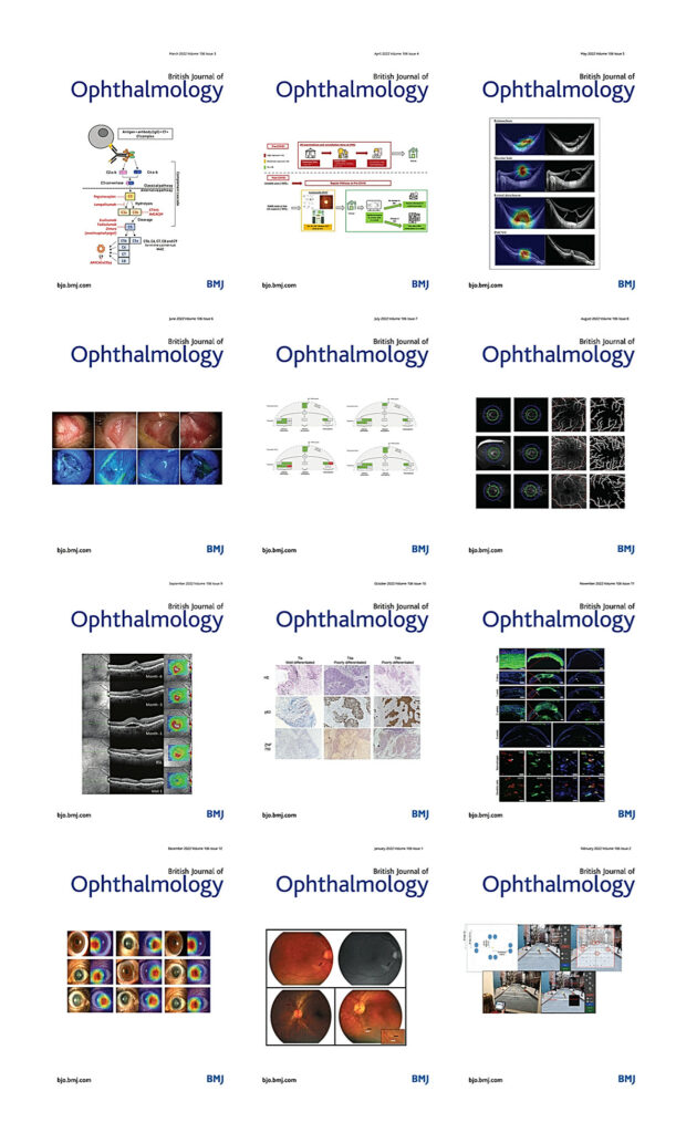 British Journal of Ophthalmology 2022 Full Archives Ophthalmology Library