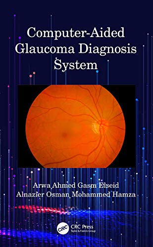 Computer Aided Glaucoma Diagnosis System