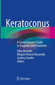 Keratoconus A Comprehensive Guide to Diagnosis and Treatment