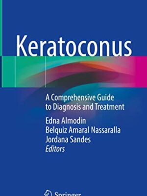 Keratoconus A Comprehensive Guide to Diagnosis and Treatment