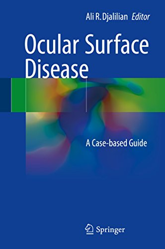 Ocular Surface Disease A Case Based Guide