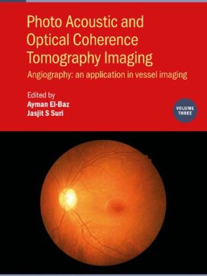 Photo Acoustic and Optical Coherence Tomography Imaging Angiography An Application in Vessel Imaging Volume 3