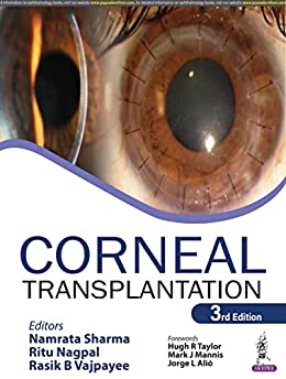 Corneal Transplantation 3rd edition