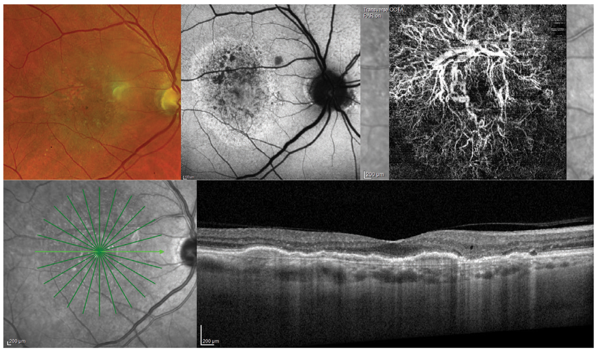 2023 Guide to Ophthalmic Imaging: A Comprehensive Overview 1 Ophthalmic Imaging