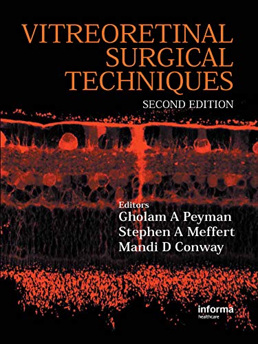 Vitreoretinal Surgical Techniques Second Edition 2nd Edition