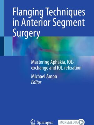 Flanging Techniques in Anterior Segment Surgery Mastering Aphakia IOL exchange and IOL refixation