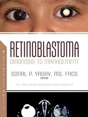 Retinoblastoma Diagnosis to Management