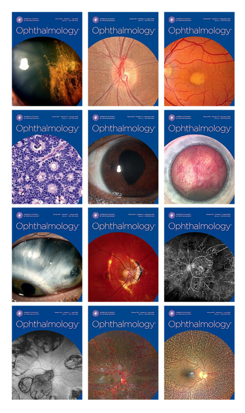 Ophthalmology 2023 Full Archives