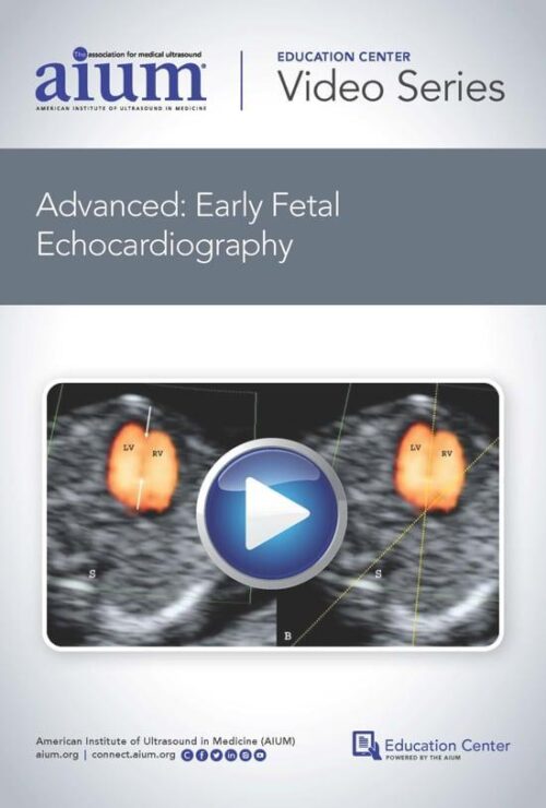 advanced early fetal echocardiography