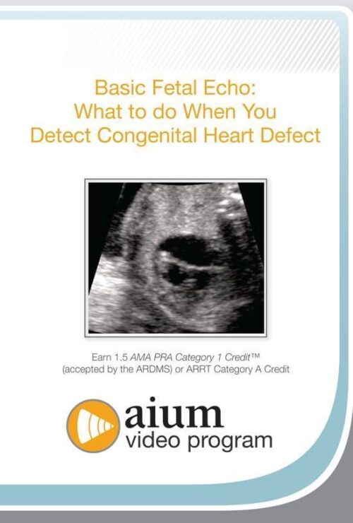 aium basic fetal echo what to do when you detect congenital heart defect medical video courses 408828 720x 1