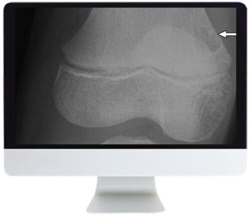 arrs clinical case based review of musculoskeletal imaging 2019 medical video courses