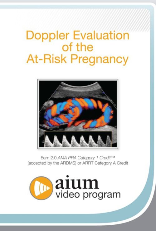 doppler evaluation of the at risk pregnancy