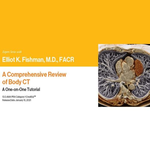 expert series with elliot k fishman m d facr a comprehensive review of body ct a one on one tutorial 1 1