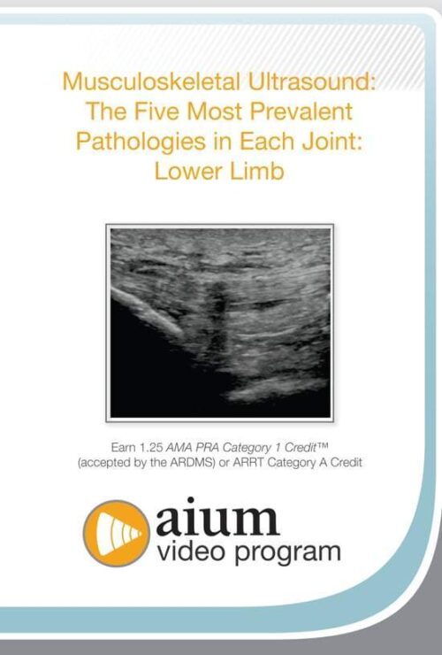 msk ultrasound the five most prevalent pathologies in each joint upper limb 1