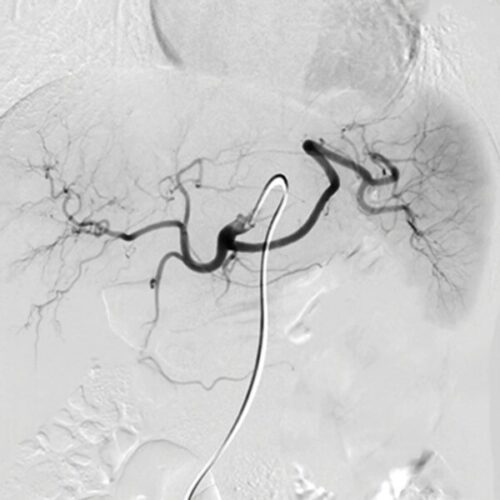 oakstone nyu langone vascular and interventional radiology review and update 2023 600x600 1