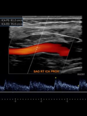 oakstone society for vascular medicine comprehensive review of vascular ultrasound interpretation and registry preparation 2023 600x600 1