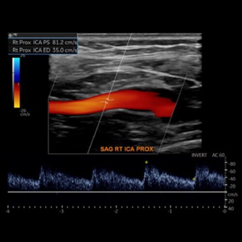 oakstone society for vascular medicine comprehensive review of vascular ultrasound interpretation and registry preparation 2023 600x600 1