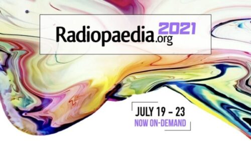 radiopedia 2021 600x338 1
