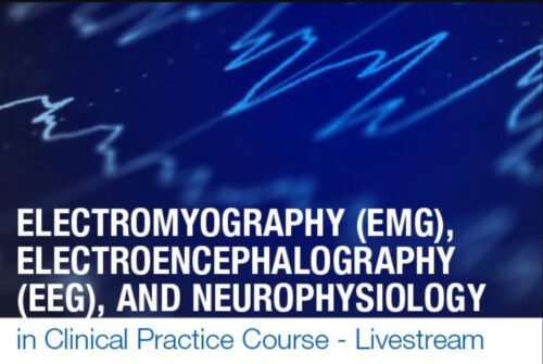 1649835128 electromyography emg electroence