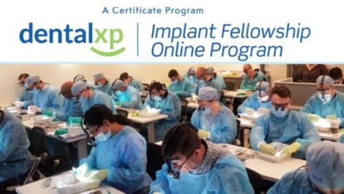 dentalxp implant fellowship online program 600x338 1